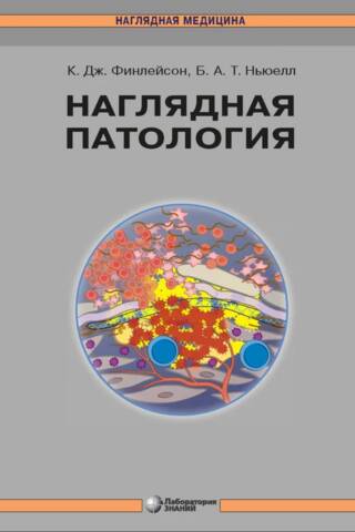 Наглядная патология