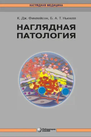 Vizuālā patoloģija