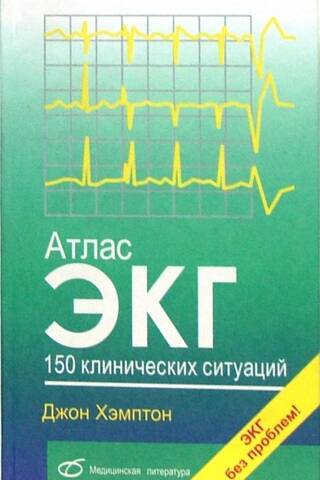 ECG Atlas. 150 clinical situations
