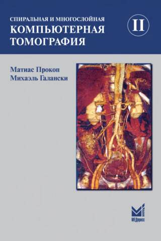 Спиральная и многослойная компьютерная томография. Том II