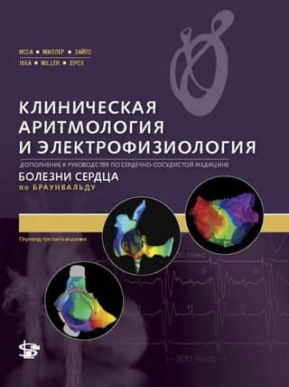 Клиническая аритмология и электрофизиология. Дополнение к руководству по сердечно-сосудистой медицине. Болезни сердца по Браунвальду