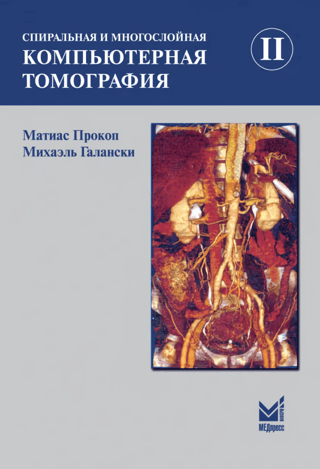 Spiral and Multislice Computed Tomography. Volume II