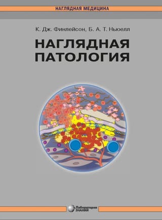 Наглядная патология