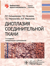 Дисплазия соединительной ткани