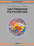 Наглядная патология