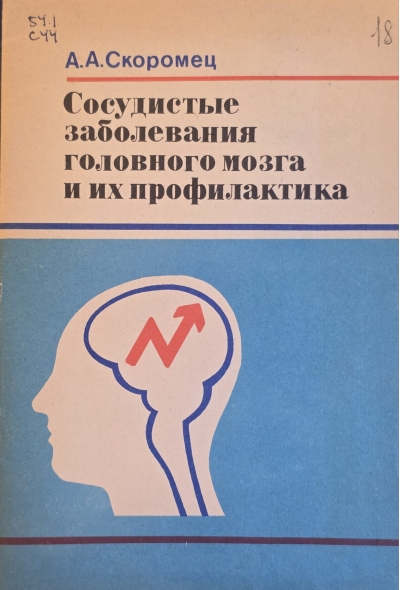 Сосудистые заболевания головного мозга